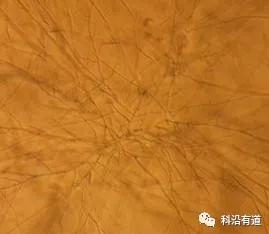 细胞培养常见问题及解决方法