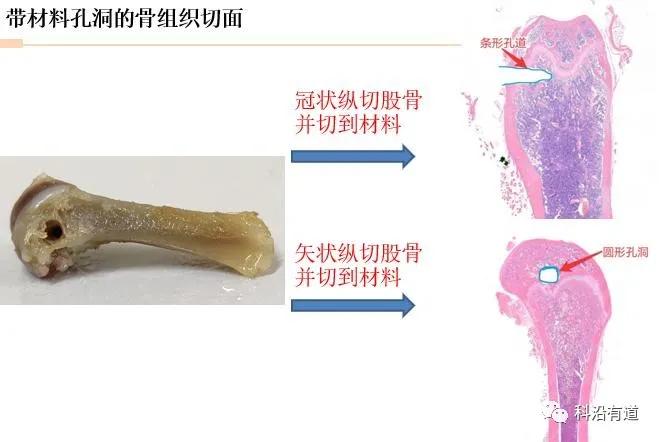 骨组织常见部位取材选择