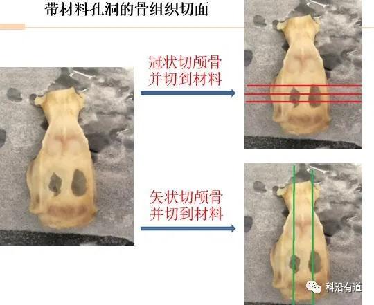 骨组织常见部位取材选择
