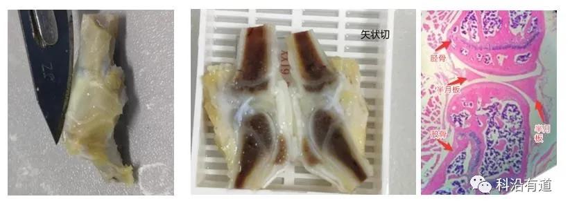 骨组织常见部位取材选择