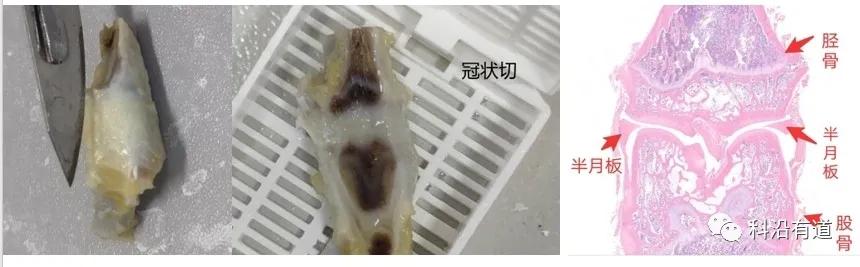 骨组织常见部位取材选择
