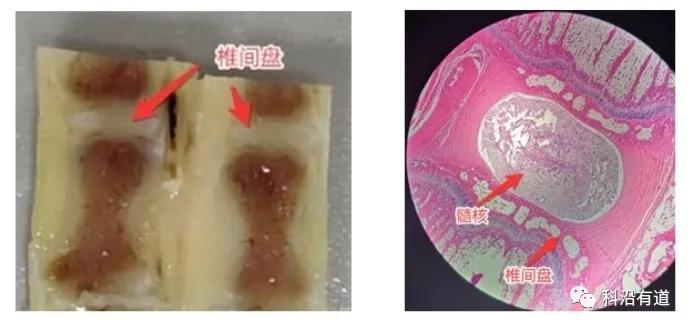骨组织常见部位取材选择