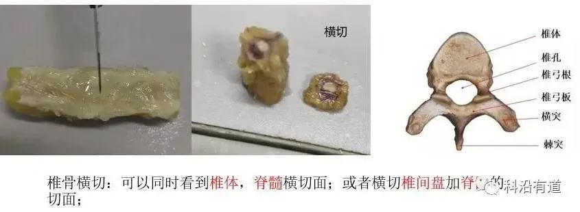 骨组织常见部位取材选择
