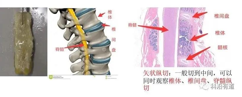 骨组织常见部位取材选择