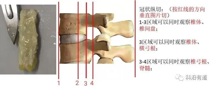 骨组织常见部位取材选择