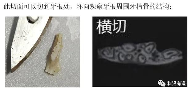 骨组织常见部位取材选择