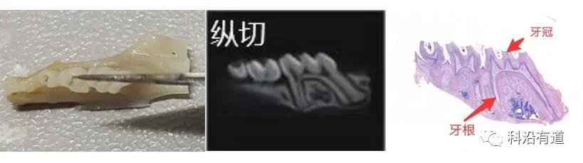 骨组织常见部位取材选择