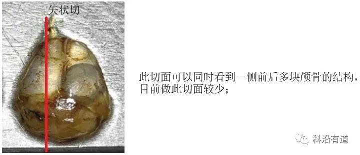 骨组织常见部位取材选择