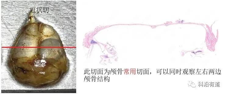 骨组织常见部位取材选择
