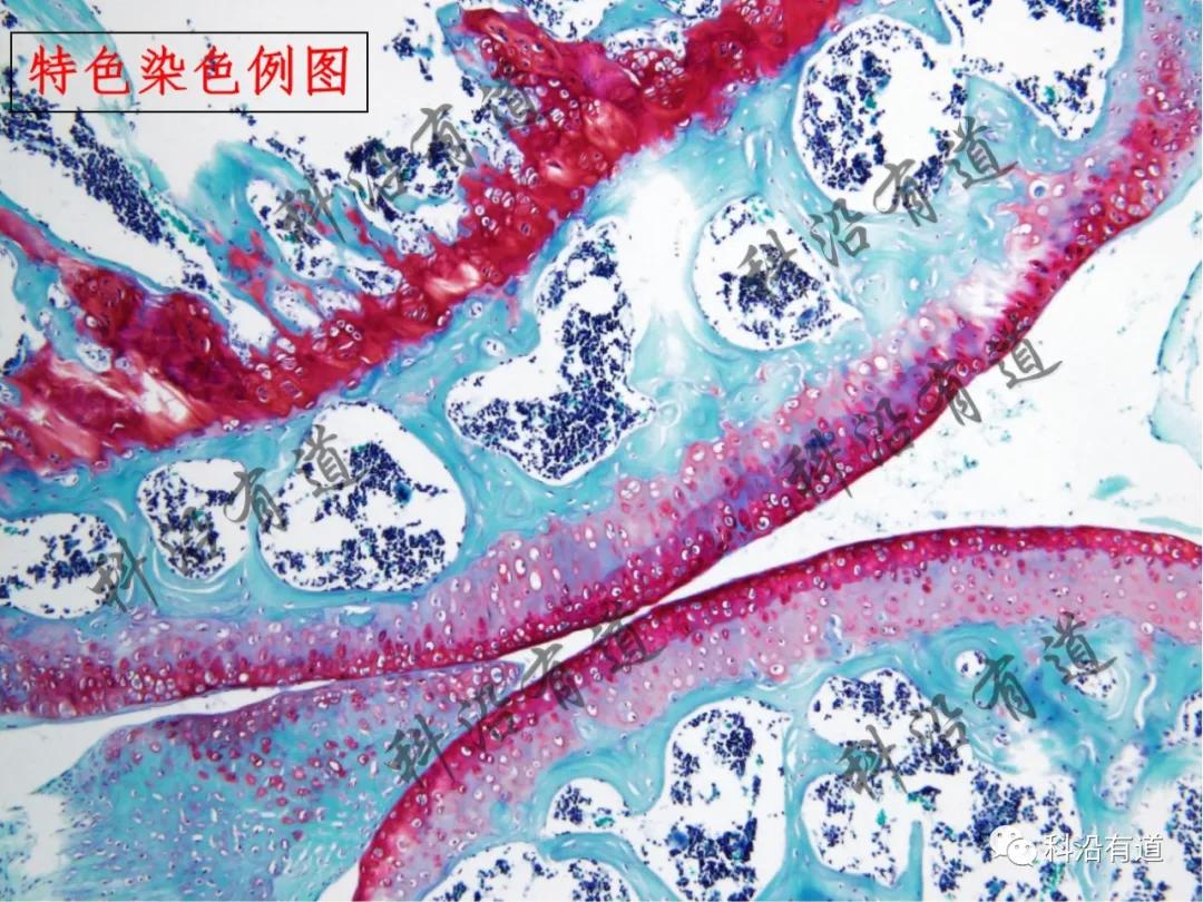 组织染色及病理分析常用指标