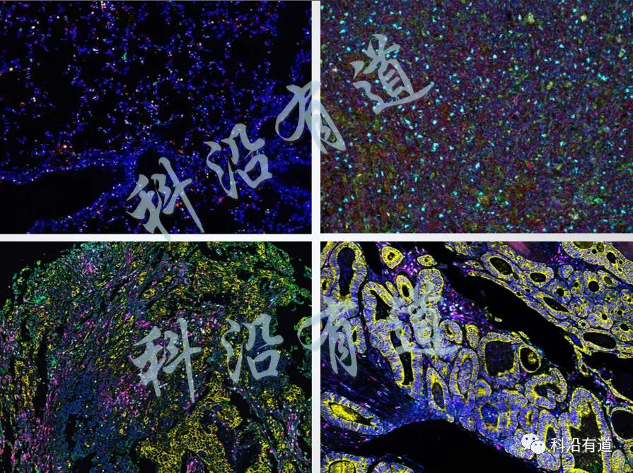 组织染色及病理分析常用指标
