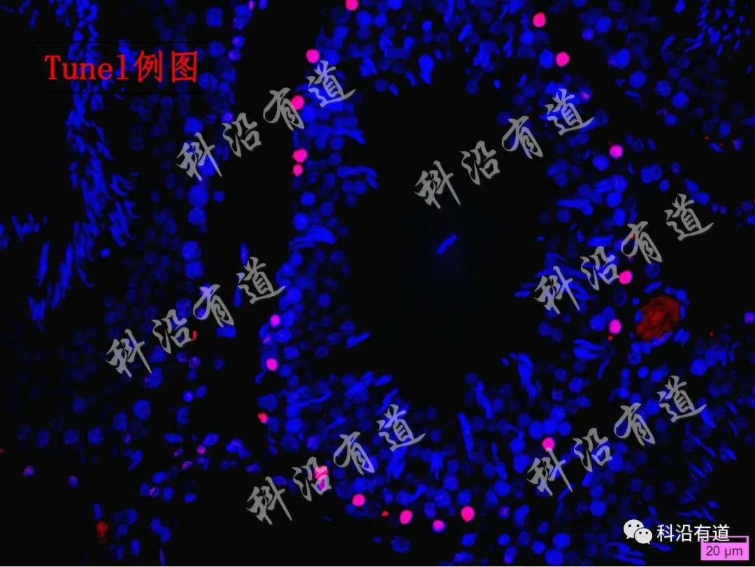组织染色及病理分析常用指标
