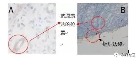 免疫组化IHC常见问题与解决方案