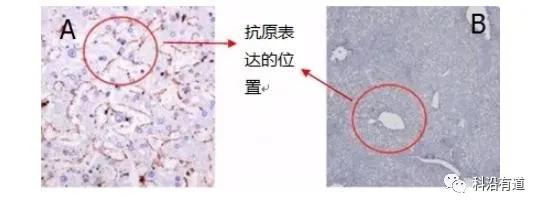 免疫组化IHC常见问题与解决方案