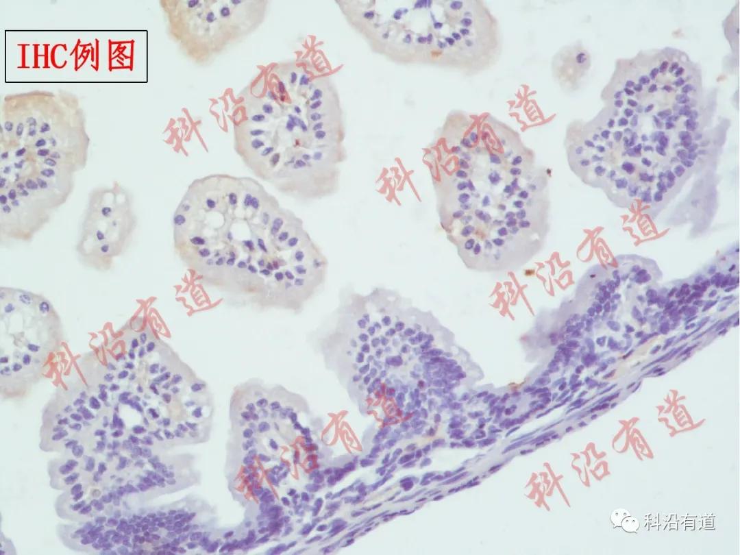 免疫组化IHC实验步骤