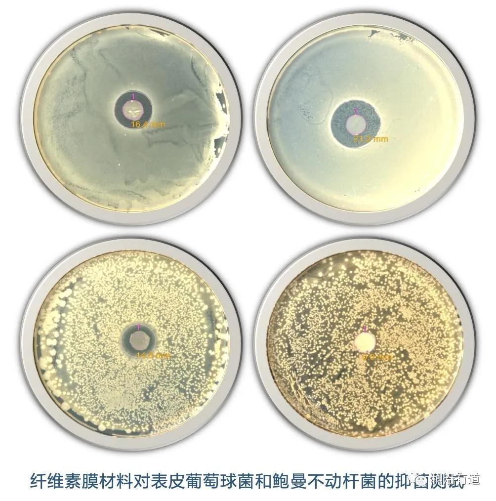 材料类抑菌实验